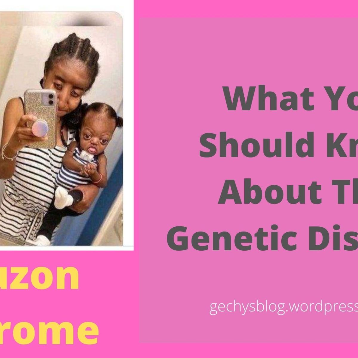 Crouzon Syndrome: What You Should Know About This Genetic Disorder